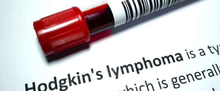 Better understand Hodgkin lymphoma.