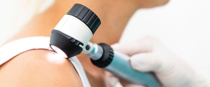 Quels sont les biomarqueurs et mutations génétiques les plus fréquentes dans le cancer de la peau ?