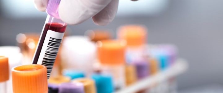 Studi osservazionali: alcuni esempi in ematologia.